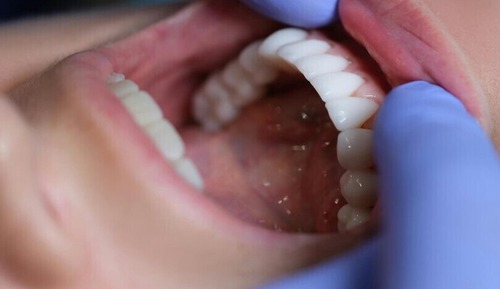 Dental Program Elite Implant Heritage Retreat